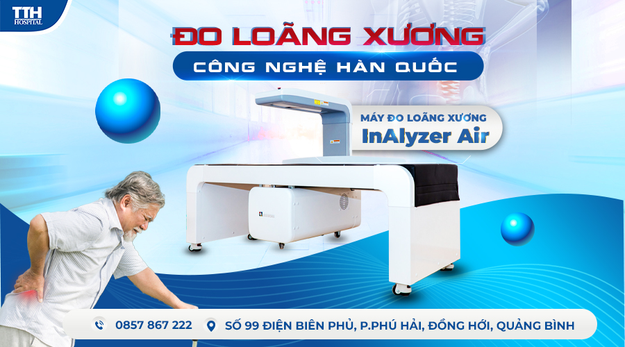 Một số triệu chứng loãng xương phổ biến và cách phòng ngừa hiệu quả